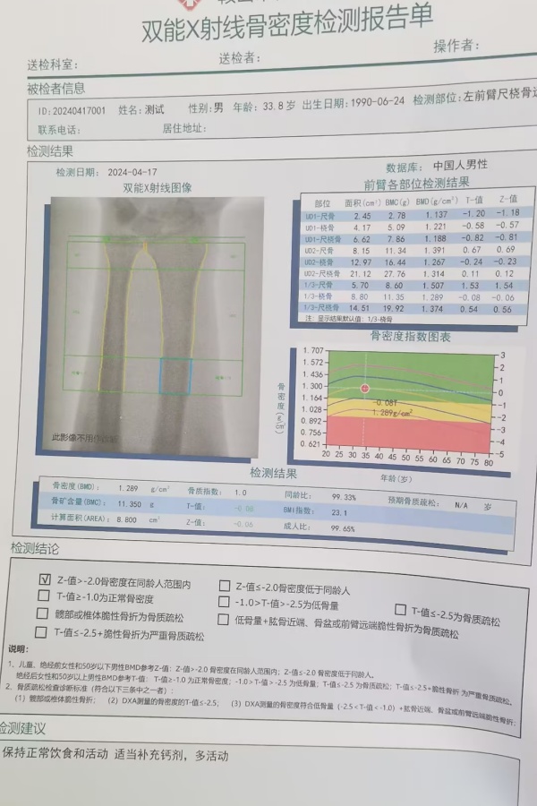 雙能X射線骨密度儀：準確測量骨密度，助力骨質(zhì)疏松防治，守護骨骼健康